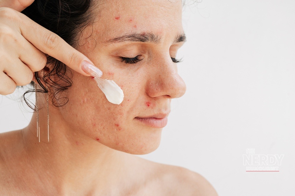 A patient applies topical acne cream — Utah AI prescriptions under the Nolla pilot are limited to physician-approved topical acne treatments